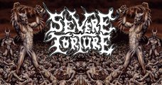 Severe Torture (NL)