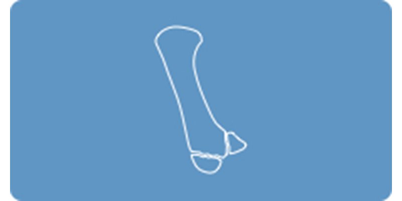 Advanced Fractures 2025